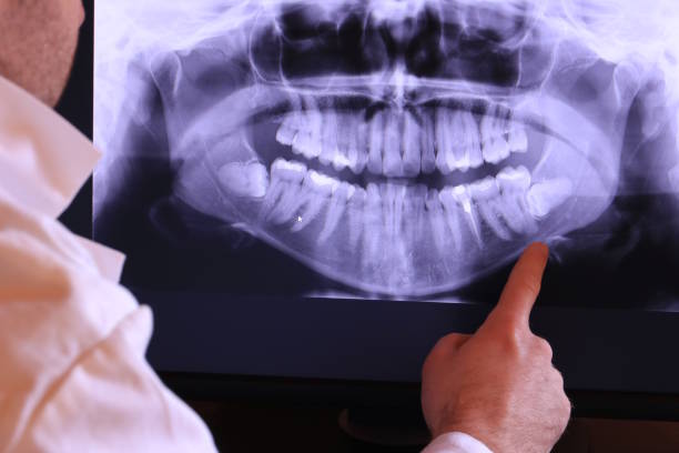 Best After-Hours Dental Trauma Care in Portola Valley, CA