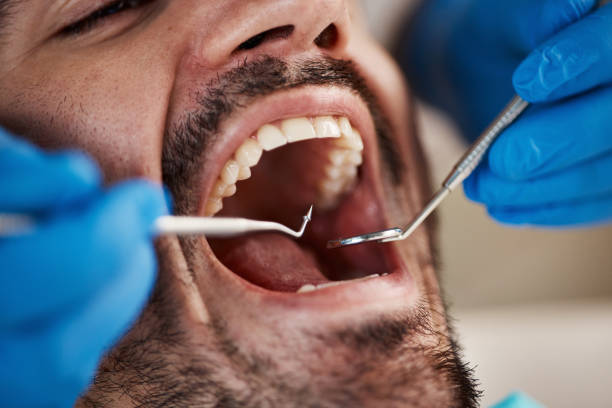 Best Emergency Denture Repair in Portola Valley, CA
